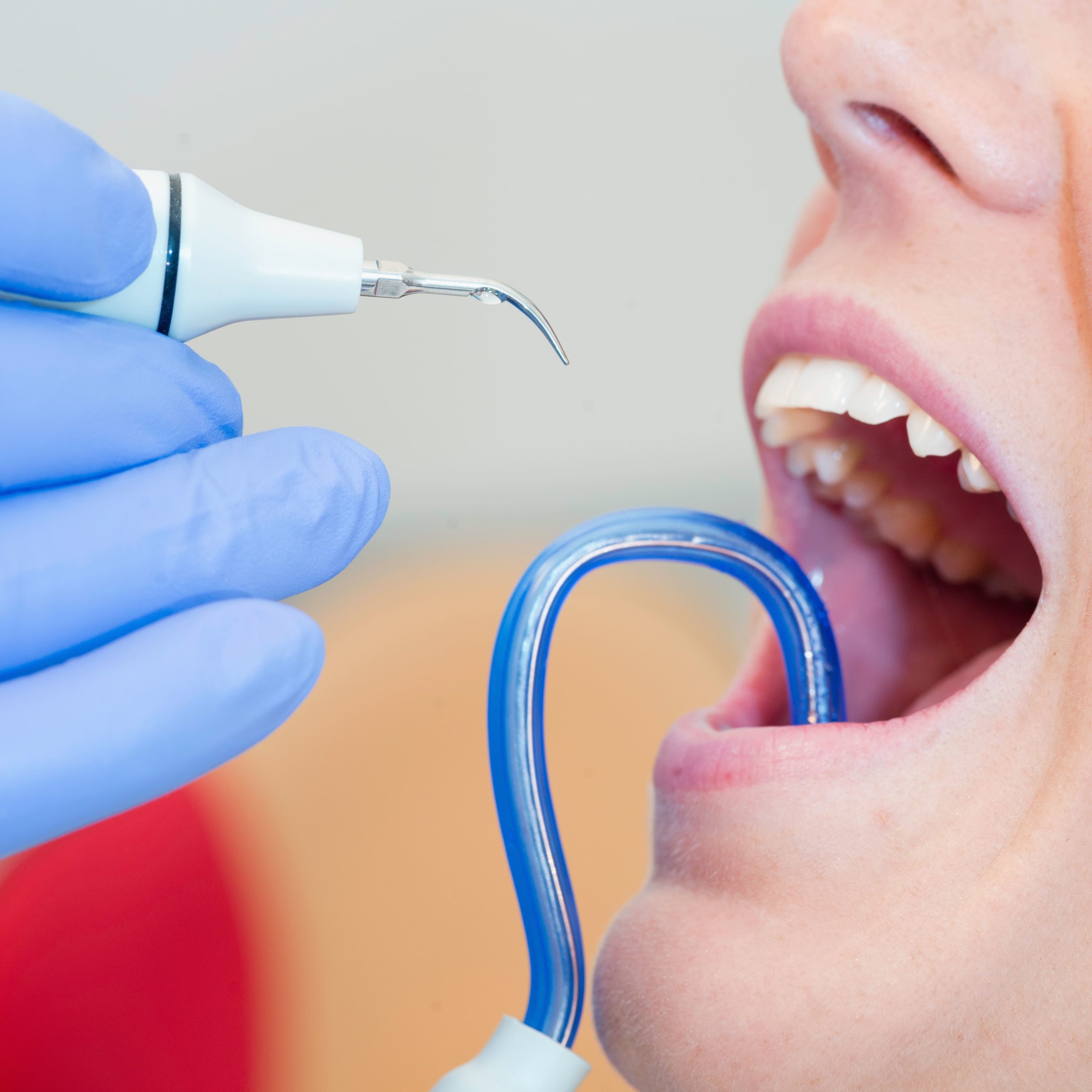 Endodoncia