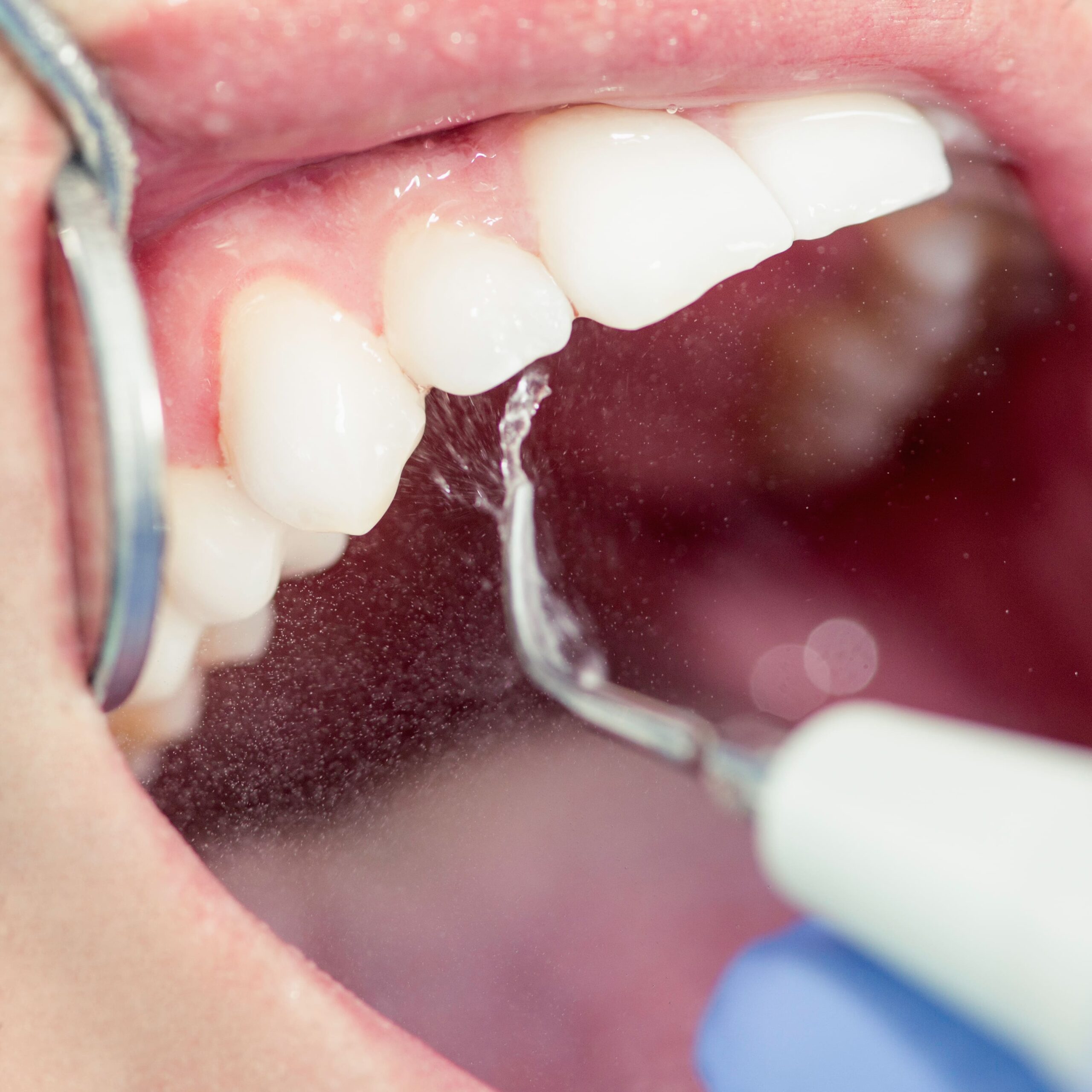 Periodoncia